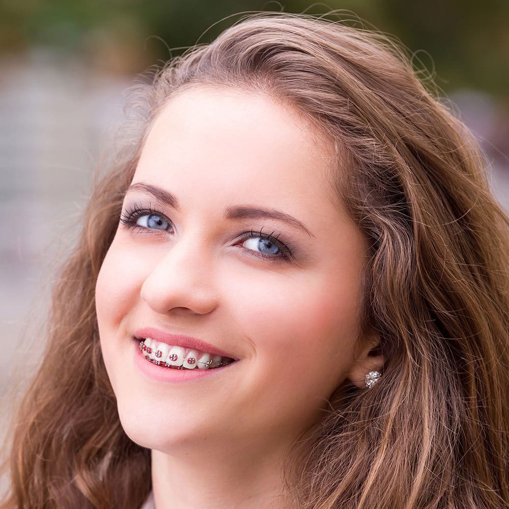 Portrait of Smiling Teenager wearing Braces after visiting Joseph LaPonzina Orthodontics