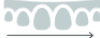 Orthodontic archwire with rounded loops showing tooth movement progression in orthodontic treatment.