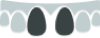 Four dental aligners or retainers displayed in a row, showing progression of orthodontic treatment stages.
