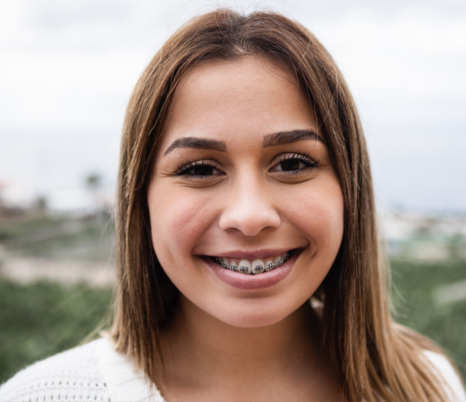 Young woman smiling at camera with braces, outdoor landscape background
