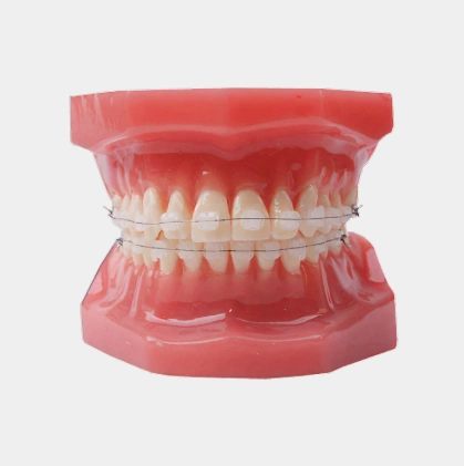Dental model showing upper and lower teeth alignment with orthodontic wire demonstration.