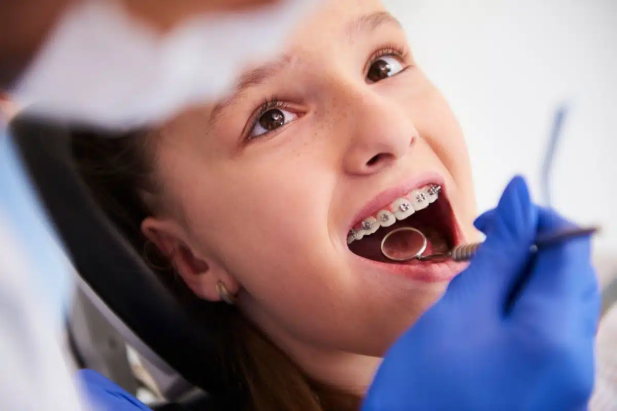 orthodontic consultation process