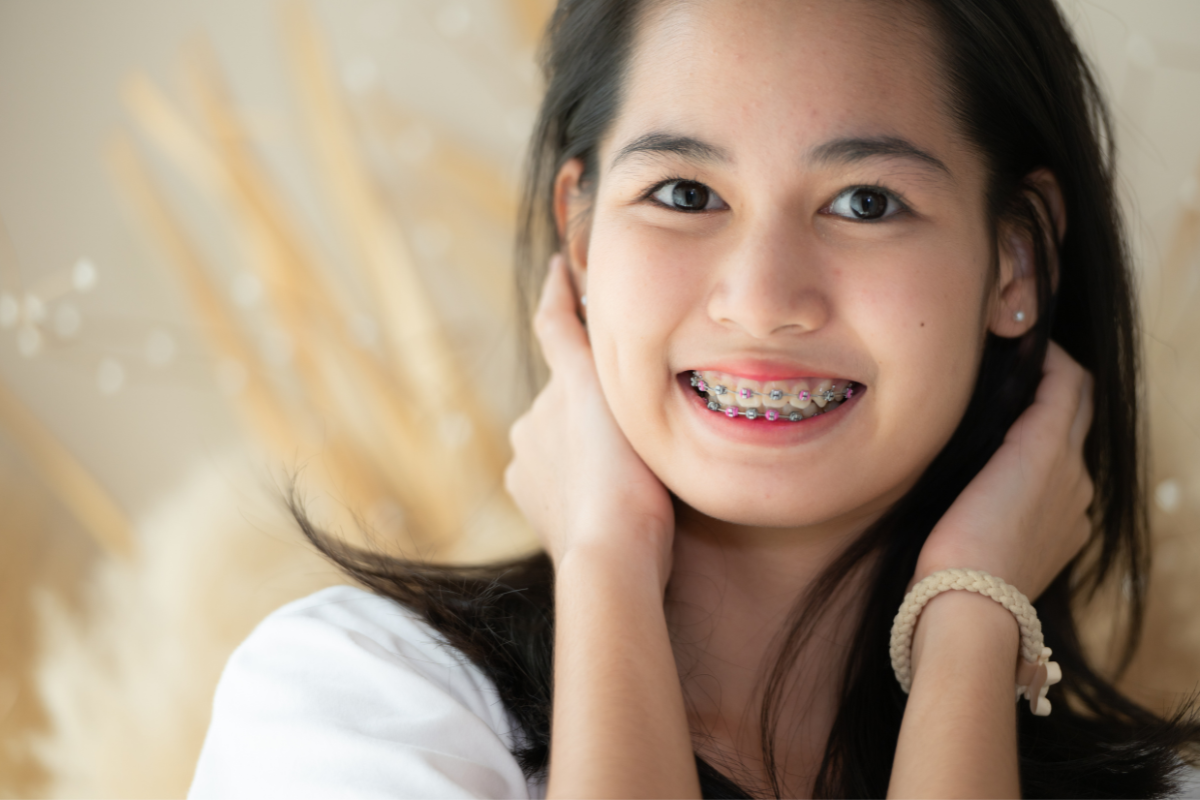 braces vs clear aligners