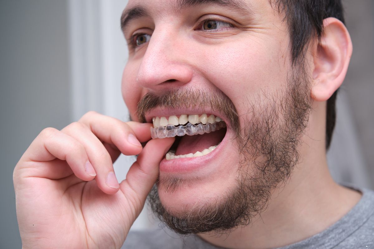 Thinking About Invisalign in Bel Air? What You Should Know First