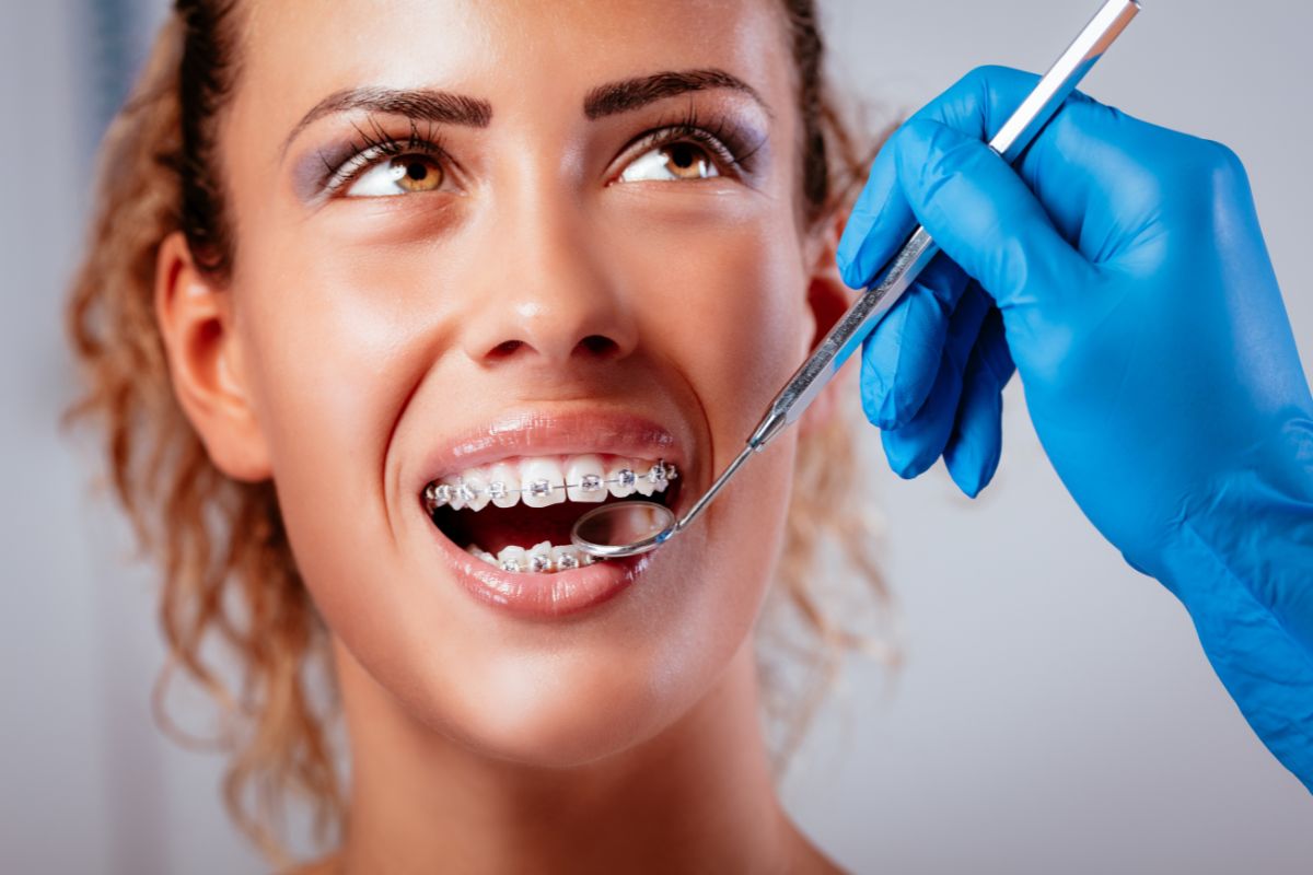 teeth shifting with age in Bel Air, MD- Dr. Joseph LaPonzina Orthodontics
